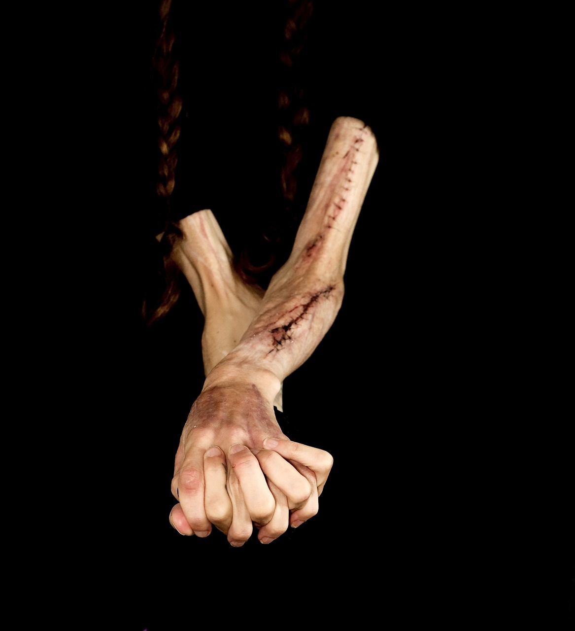 Autolesionismo: quando una lametta lenisce il dolore